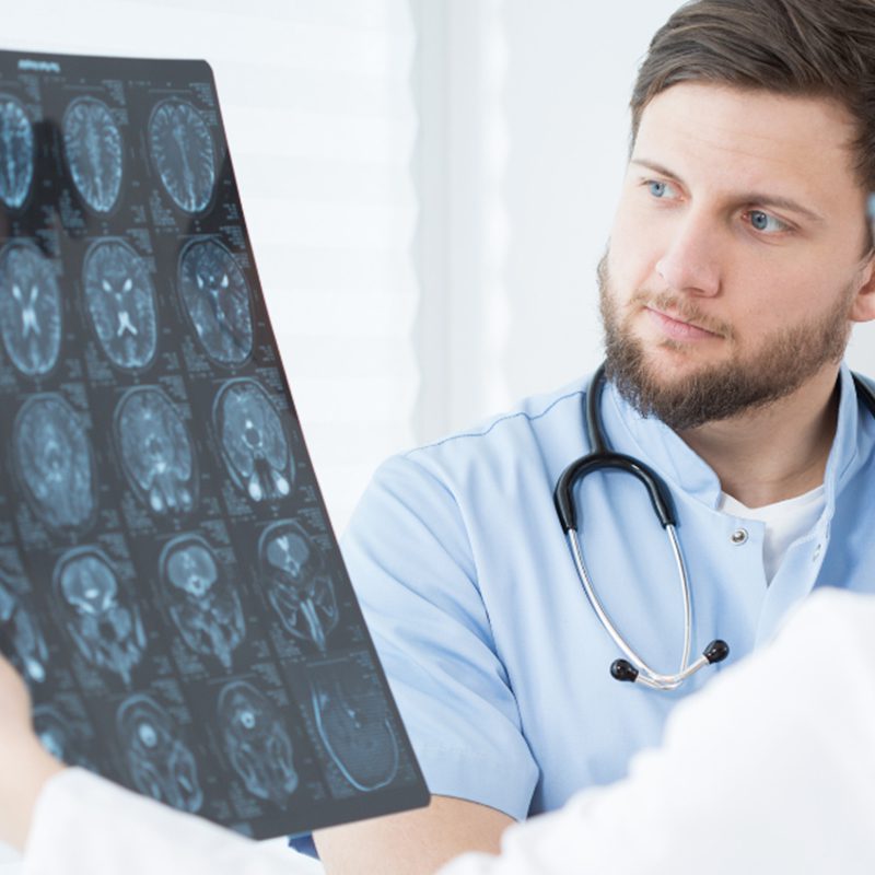 Doctor reviewing brain scans